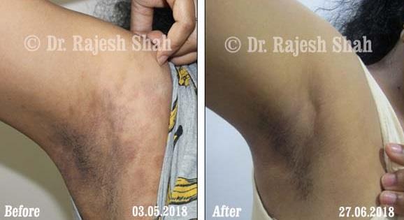 lifeforce homeopathy case-photos